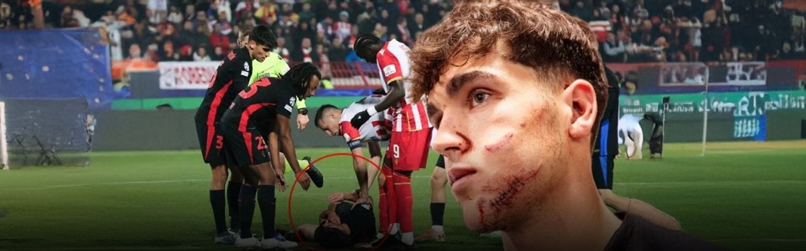 They made Barcelona's star Pau Cubarsi like this! It was covered in blood, 10 stitches were thrown 1 3 7