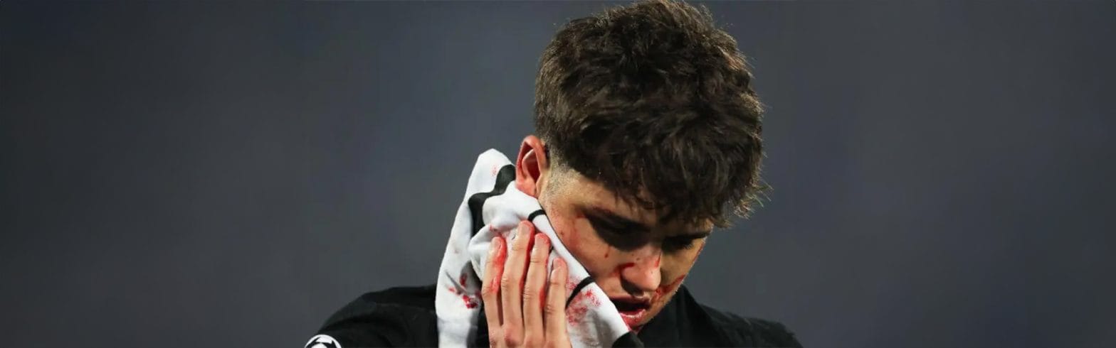 Barca's Cubarsi given 10 stitches after kick to face 1 asDsdwsDS 1
